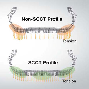 SCCT-Technologie